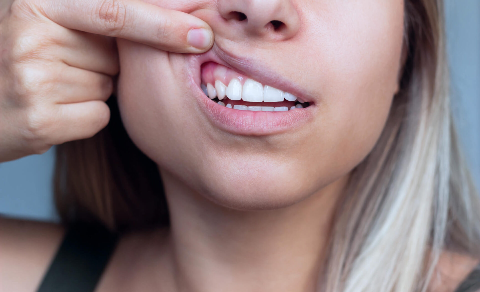 periodontologia toruń